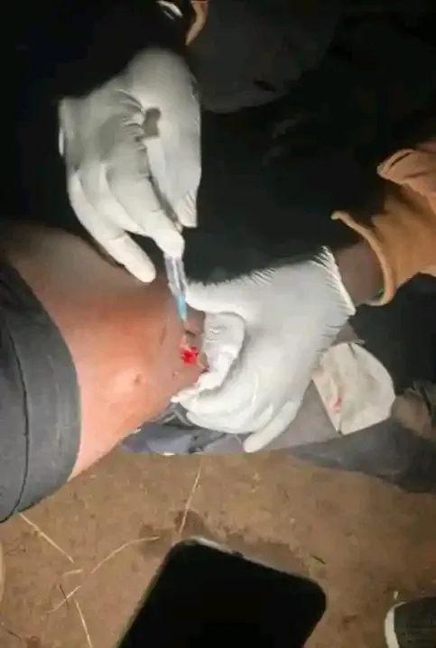 Two Men Injured After Roaming Hyena Attacks Residents in Tinderet, Nandi