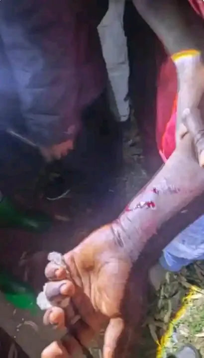 Two Men Injured After Roaming Hyena Attacks Residents in Tinderet, Nandi